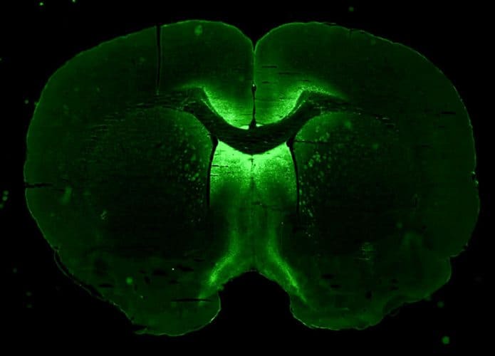 cerebro