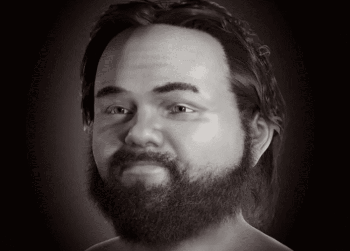 homem-com-nanismo-reconstrucao-facial-695x500.png