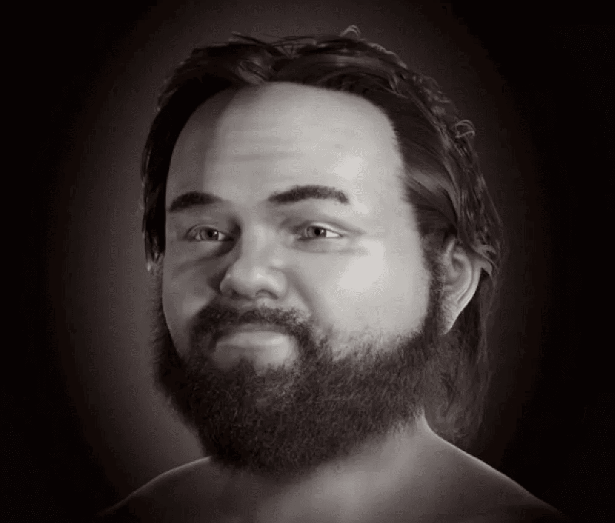 homem-com-nanismo-reconstrucao-facial.png