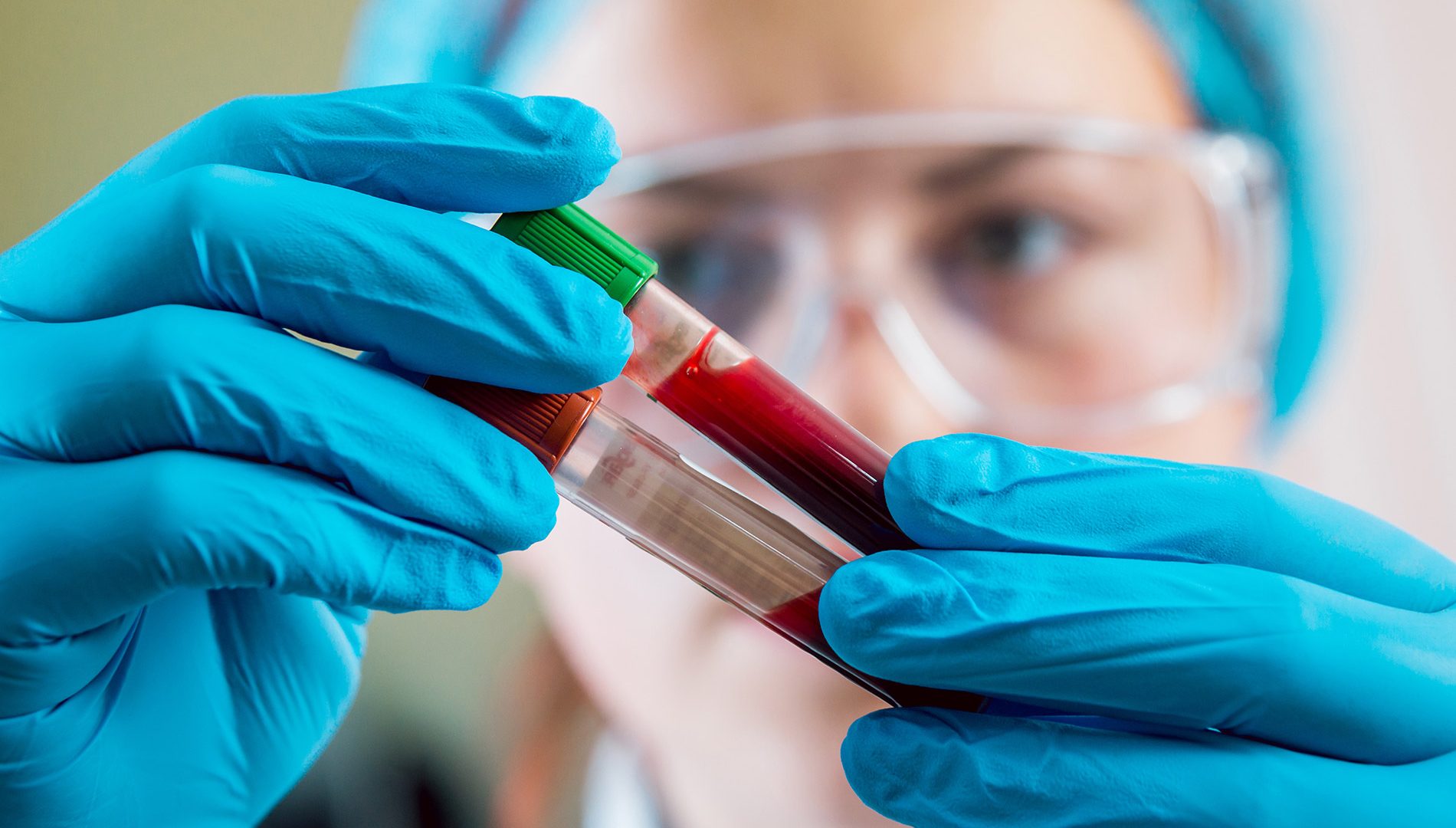 Técnica examina tubos de sangue