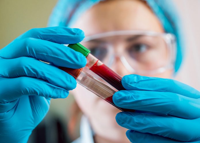 Técnica examina tubos de sangue
