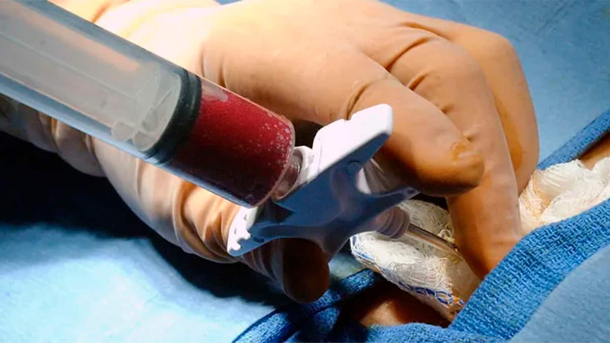 Doação de medula óssea