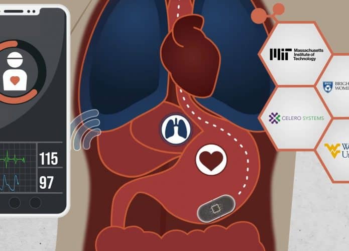 Cápsula ingerível que monitora sinais vitais no intestino