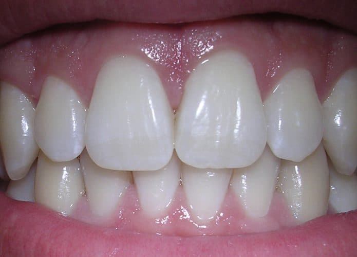 06-10-06smile-695x500