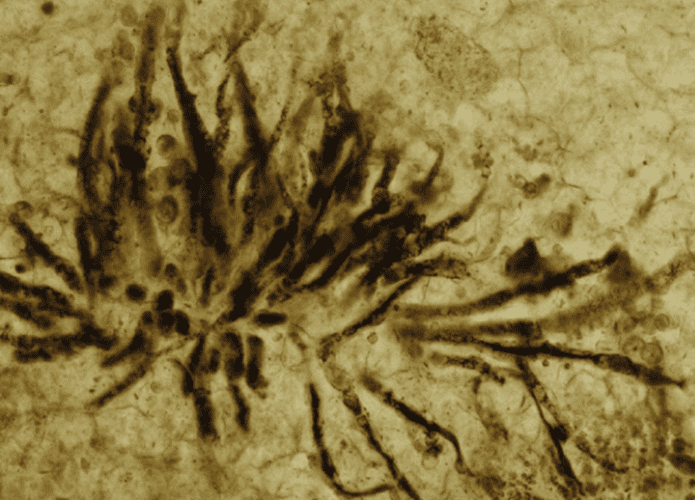 fungo-1-695x500.png