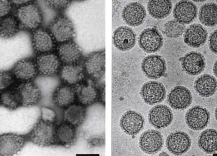 virus-1-695x500