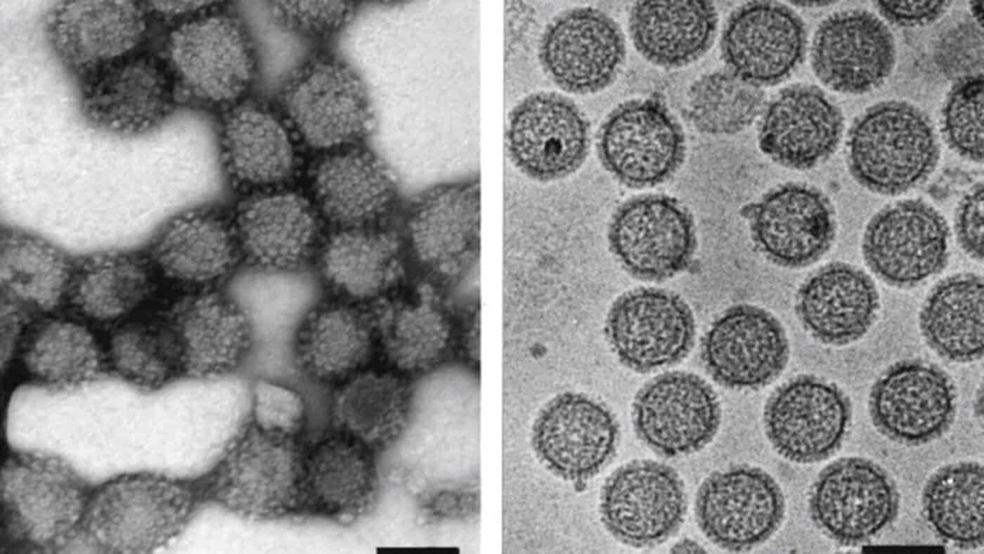 virus-1