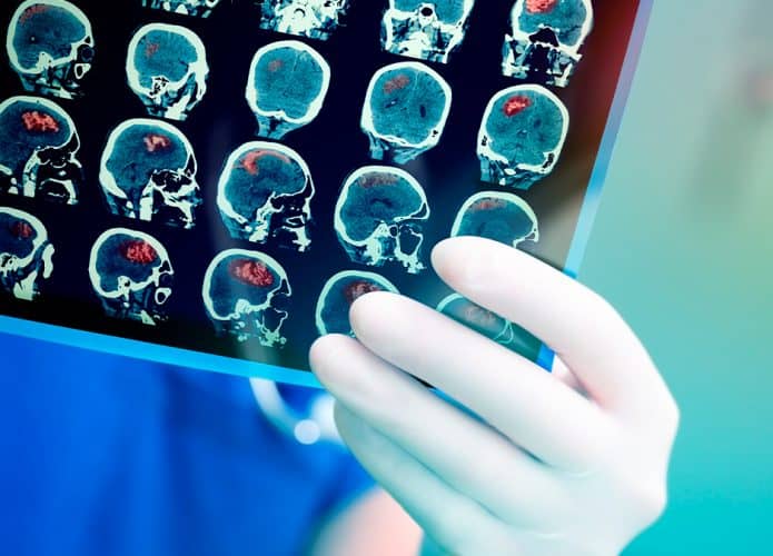 Médico segurando chapa de ressonâncias cerebrais