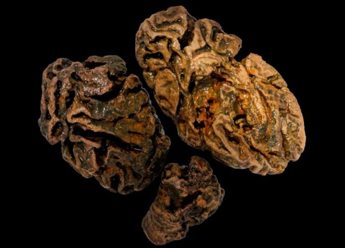 Fragmentos de cérebros de 12 mil anos