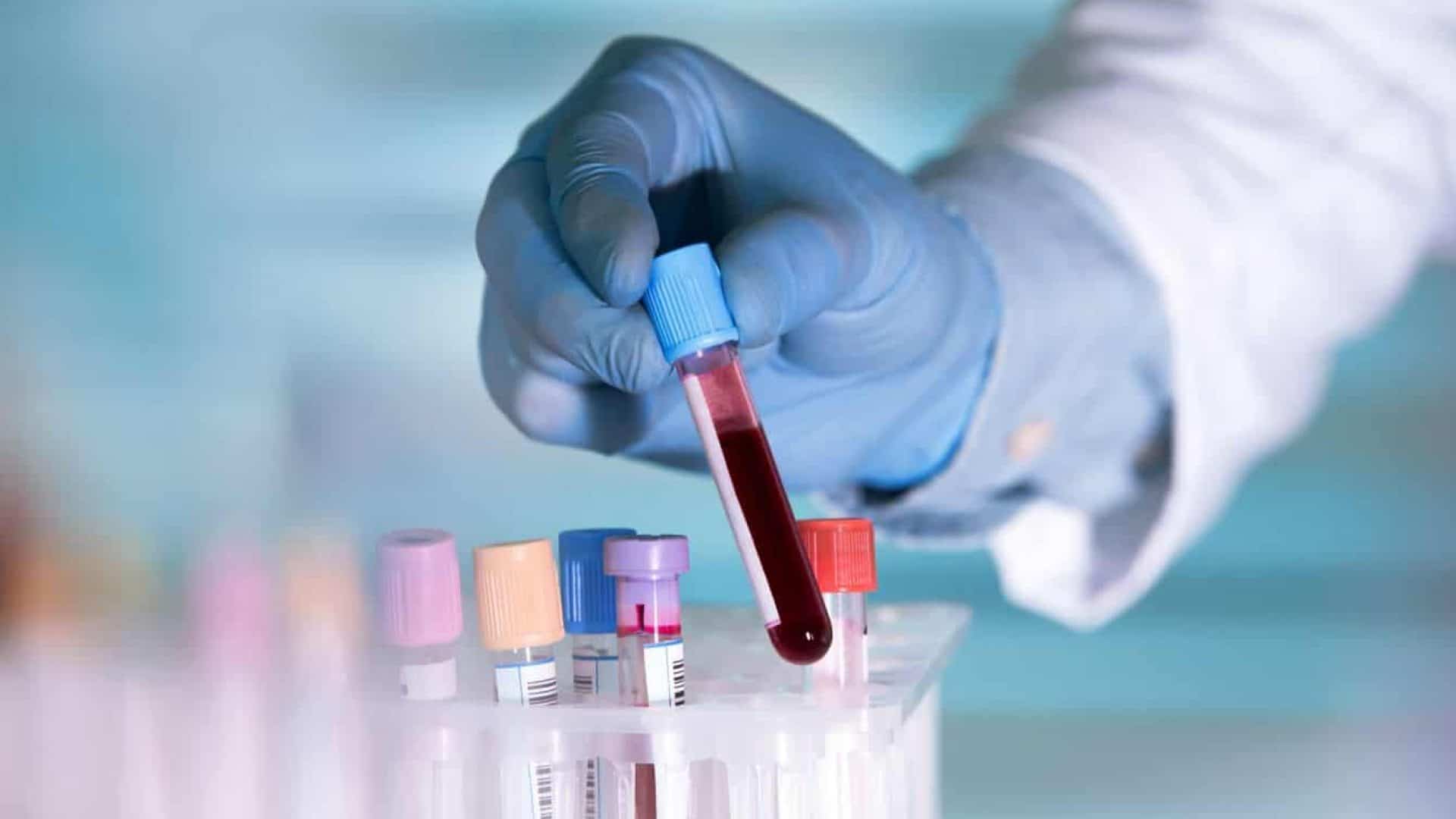 exame de sangue