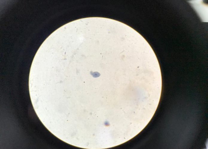 Naegleria-fowleri-695x500