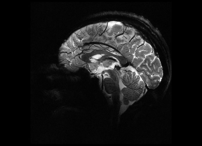cerebro-1-695x500