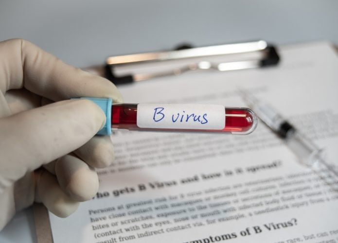 Vírus da herpes armazenado