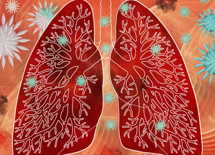 pulmao-covid-19-695x500.png