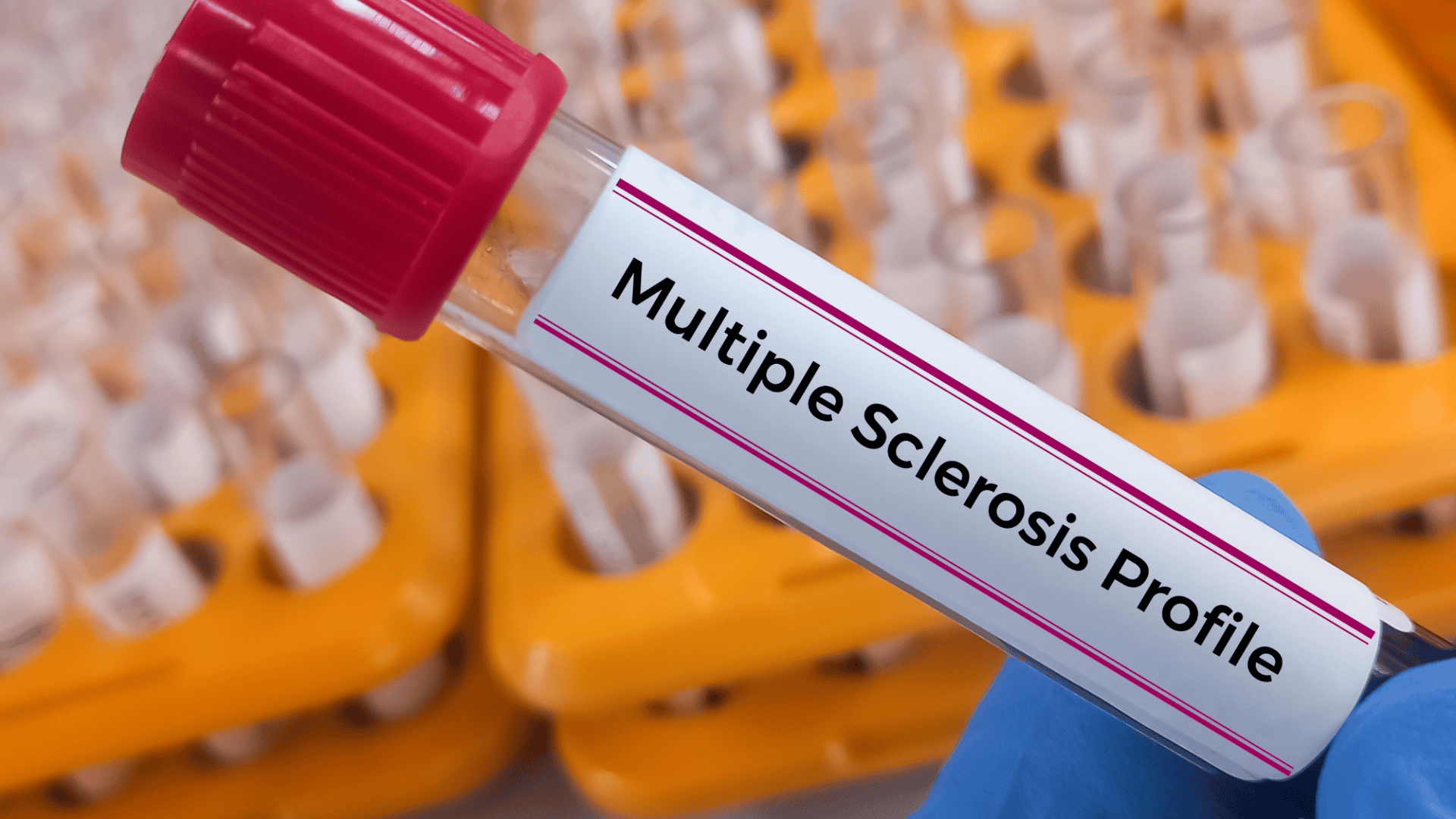 Esclerose-multipla-1920x1080.png