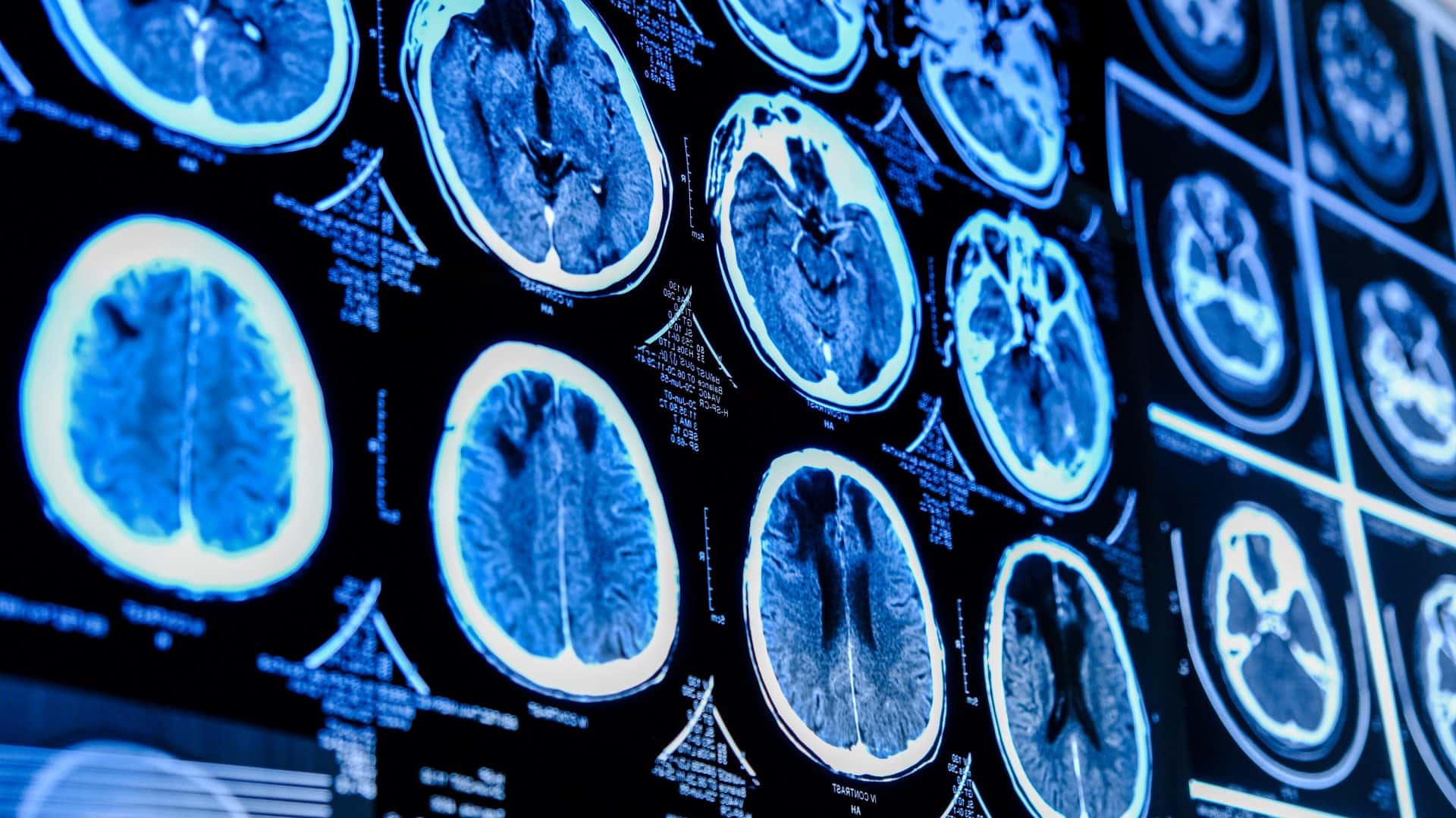 cerebro-1-1920x1080