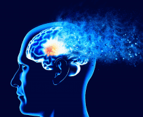 Alzheimer-210x172.png