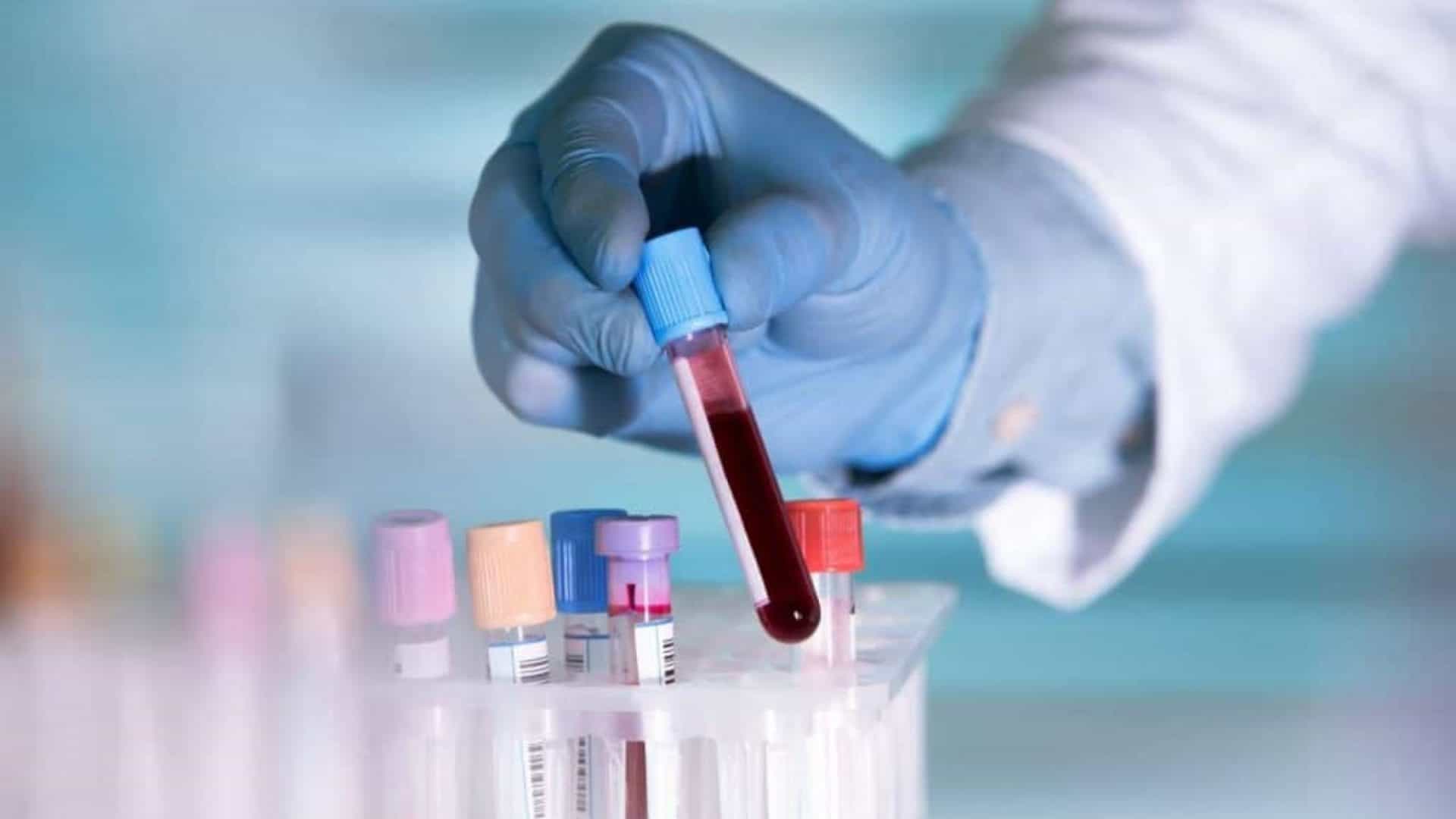 Vidro com sangue segurado por alguém com luvas azuis e jaleco branco