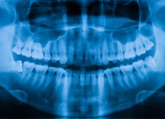 IA brasileira identifica sexo a partir de raio-X dentário