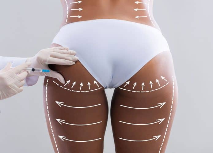 Jovem negra magra em biquíni branco com linhas abstratas recebe injeção de uma esteticista nos quadris, isolada em fundo de parede cinza, estúdio, de costas. Cuidados de beleza, modelagem do corpo, cuidados médicos e glúteos.