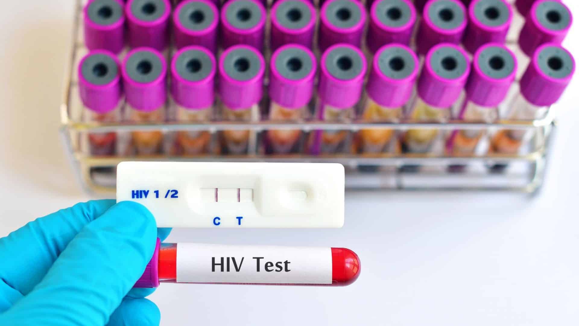 hiv