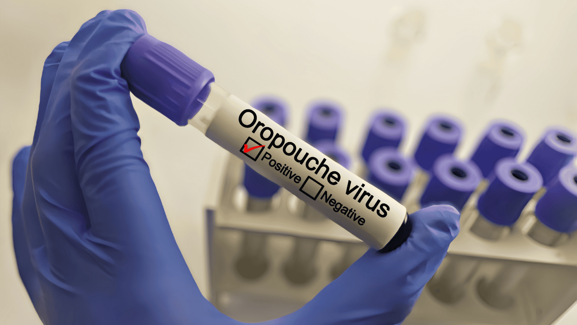 Imagem mostra uma mão com luvas azuis segurando um tubo de sangue. Nele, há um rotulo escrito 