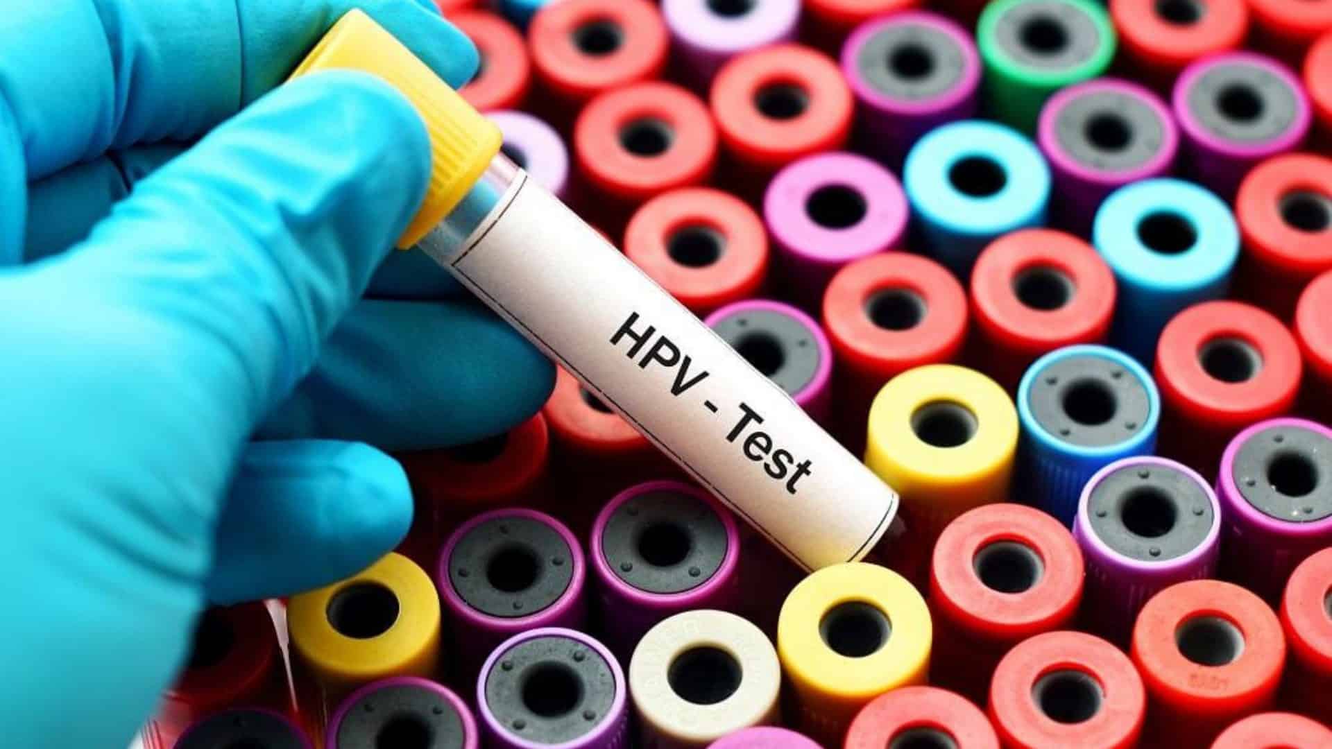 hpv