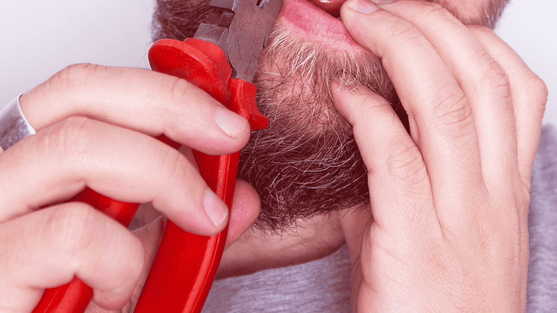 Pessoa-arrancando-dente-com-alicate-1920x1080.png