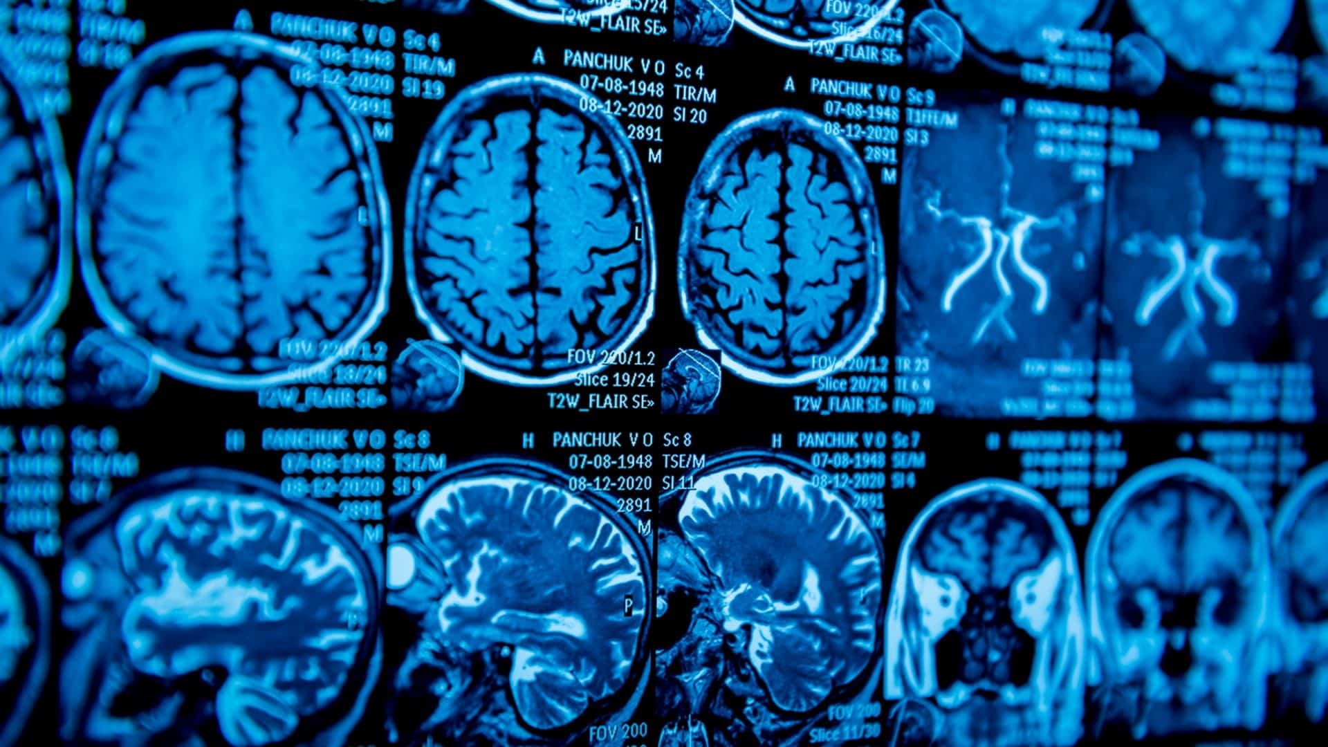 cerebro-1920x1080