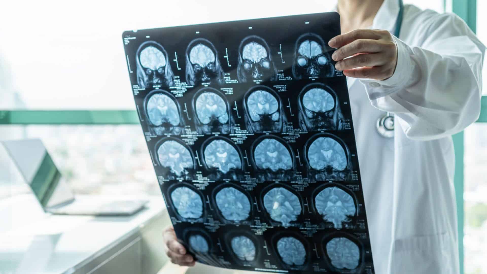 doença cerebral