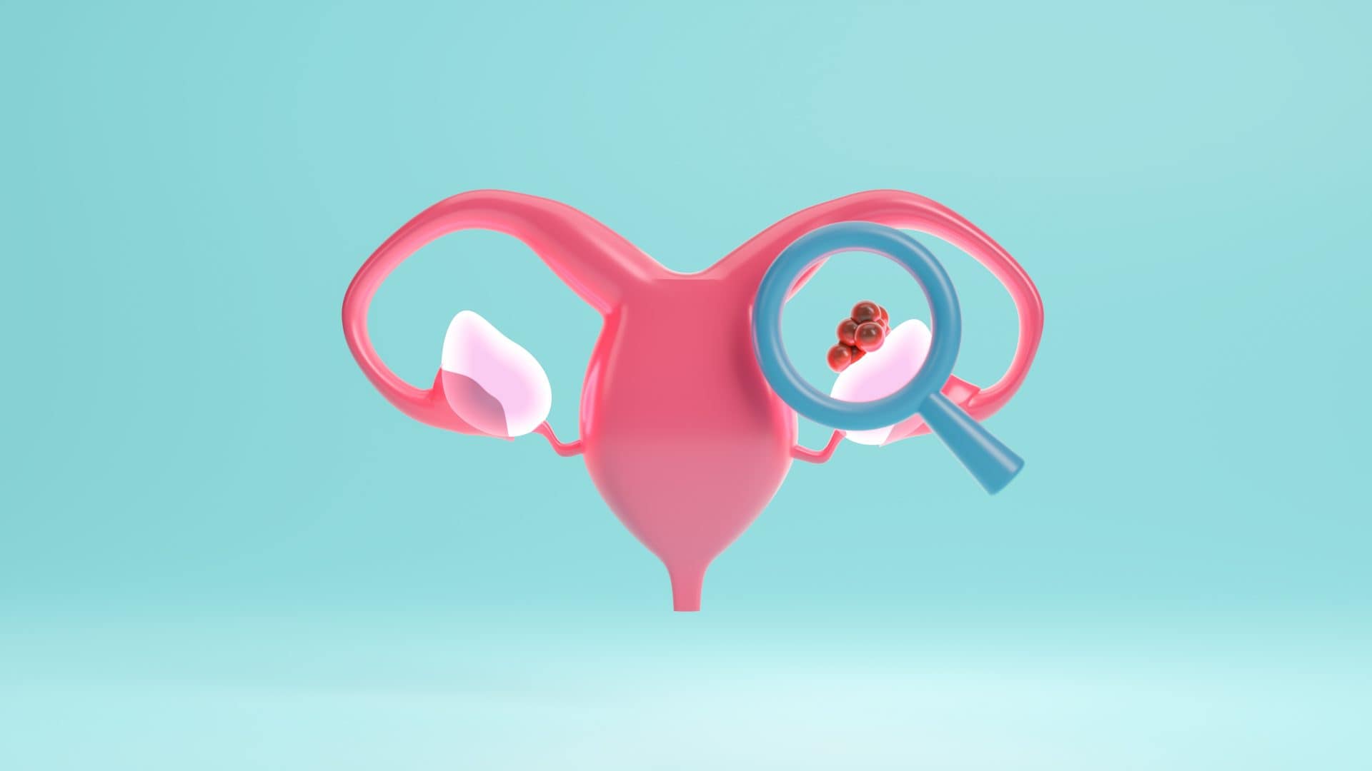 cancer-de-ovario-1920x1080