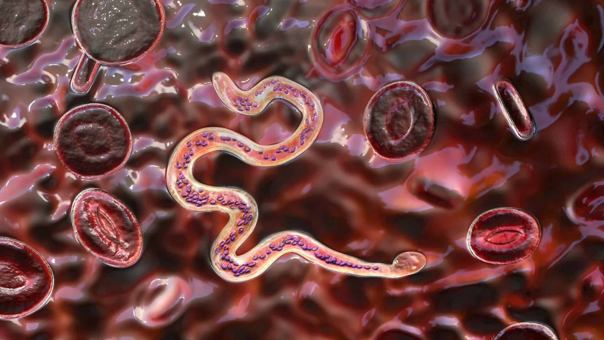 elefantiase-1-1920x1080