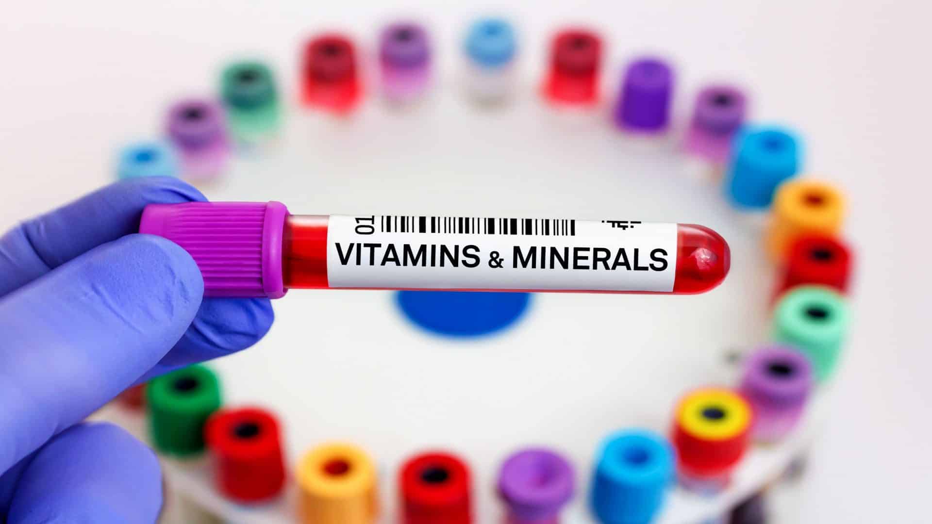 Amostra de sangue do paciente para teste de vitaminas e minerais em laboratório. médico com tubo de sangue para teste de vitaminas e minerais em laboratório
