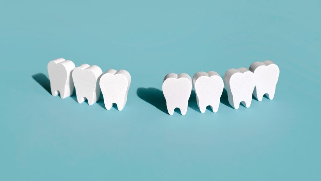 Ilustração de fileiras de dentes