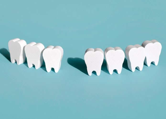 Ilustração de fileiras de dentes