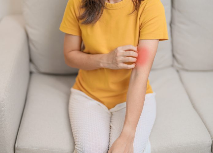 Mulher se coçando dermatite psoríase