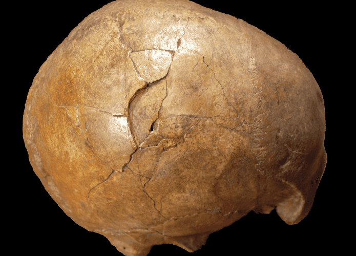 Fotografia colorida de um crânio fóssil de Cro-Magnon visto de cima e levemente de lado. O fóssil, identificado como um calvário, apresenta várias fraturas preenchidas e áreas de desgaste que evidenciam sua antiguidade. A superfície é marrom-clara e irregular, com detalhes anatômicos sutis visíveis, como linhas de sutura craniana e a textura característica de ossos antigos.