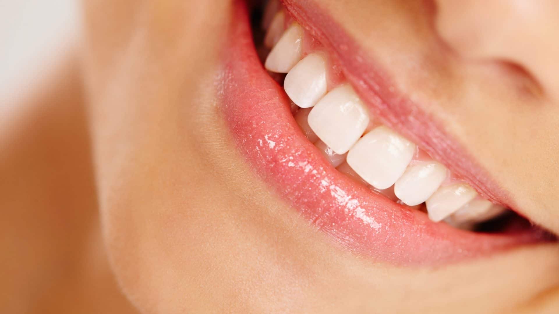 dentes-1-1920x1080
