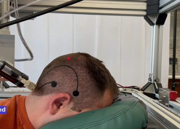 Tatuagem eletrônica para exames cerebrais