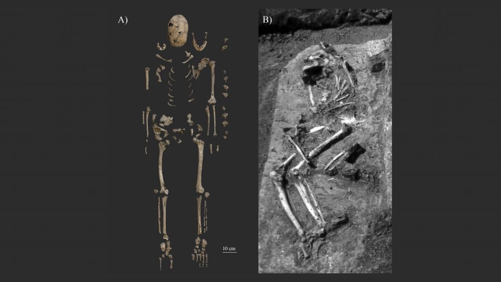Montagem com imagens de ossada de mulher enterrada com arco há mais de mil anos na Hungria