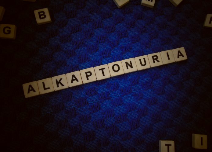 alkaptonuria-1-695x500