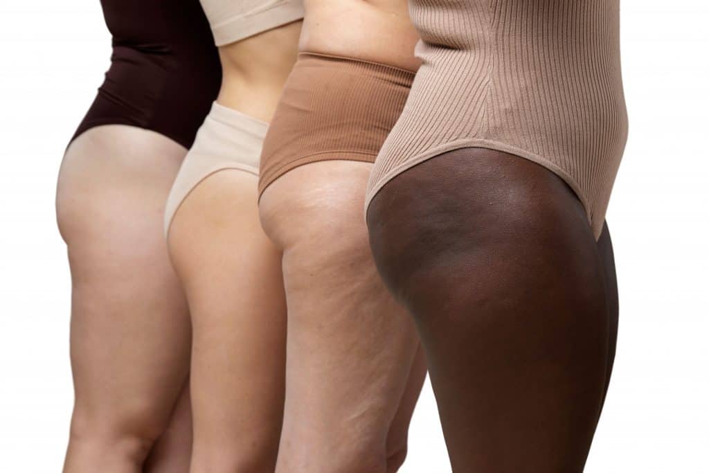corpos diferentes de mulheres com diferentes etnias