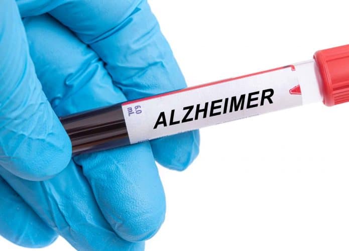 doença de alzheimer