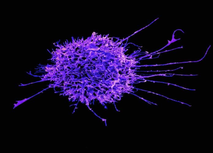 Imagem mostra linfócito T, célula do sistema imunológico