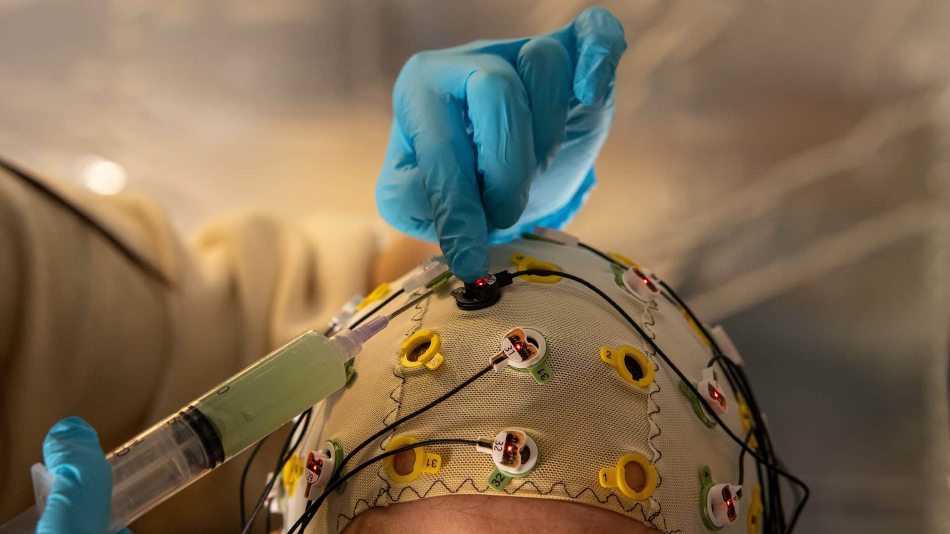 Monitoramento cerebral, com eletrodos conectados ao cérebro