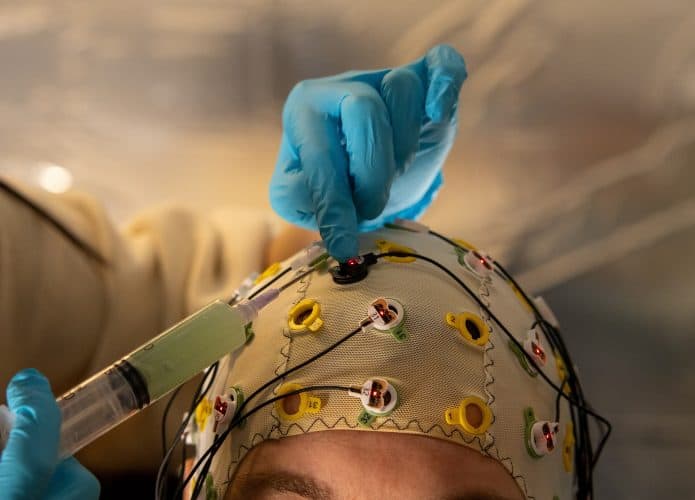 Monitoramento cerebral, com eletrodos conectados ao cérebro