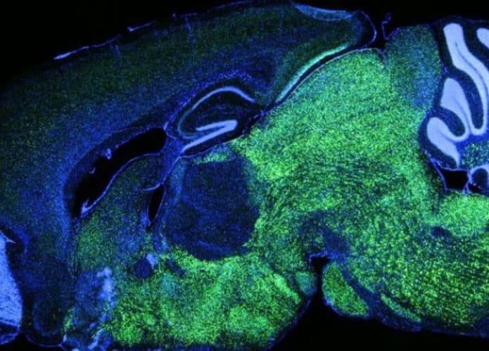 Cérebro alterado dos ratos com gene NOVA1