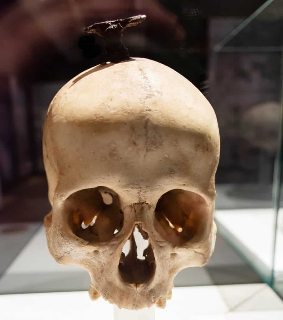Crânio de uma pessoa adulta com um prego encontrado em Puig Castellar.