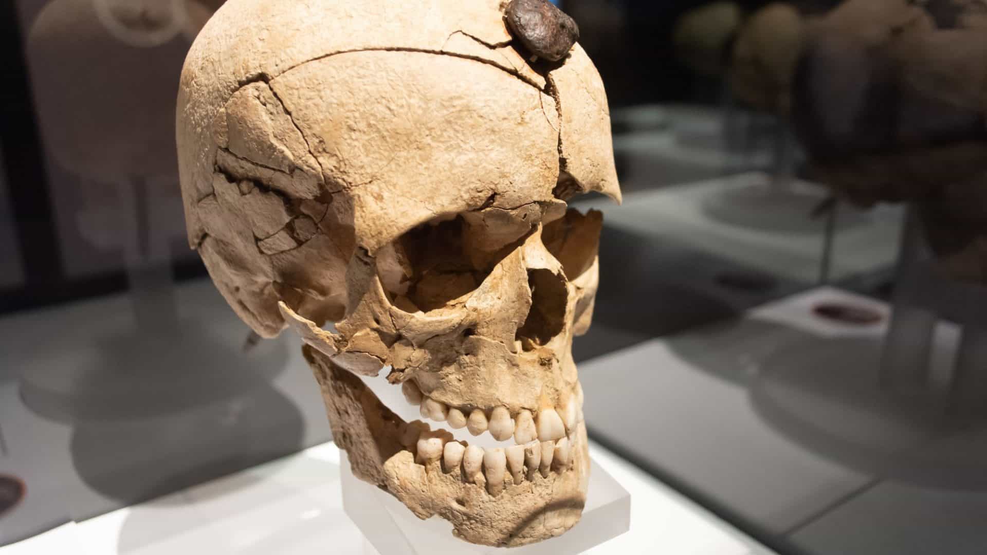 Crânio de um garoto que passou pelo ritual após a morte exposto no Museu Arqueológico da Catalunha