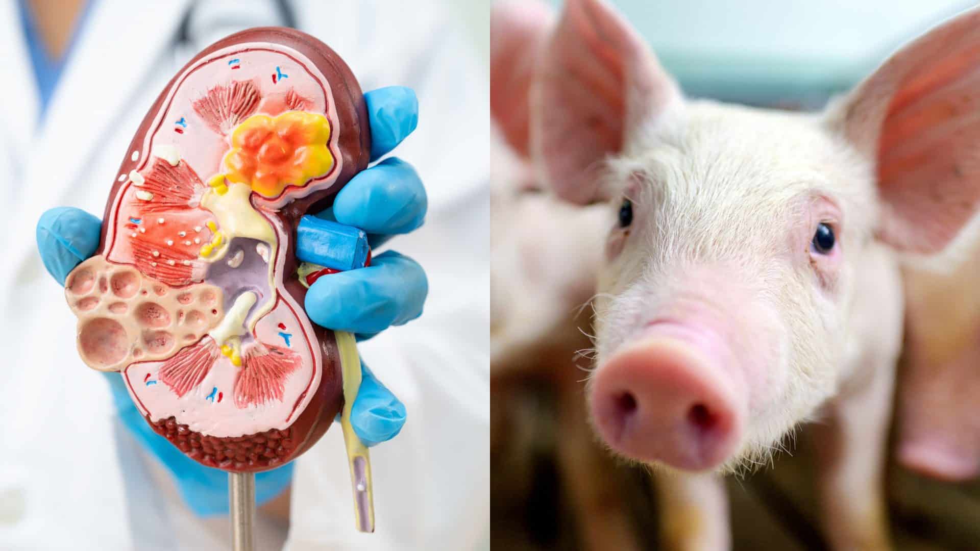Montagem de fotos de médico segurando maquete de rim cortado ao meio e de porco